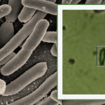 Using Raman Spectroscopy to Detect Disease-Causing Bacteria