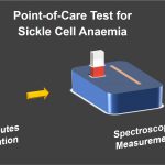Point-of-care Test for Sickle Cell Anaemia