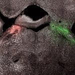 How Specific Brain Regions Drive Chemotherapy-induced Pain Response